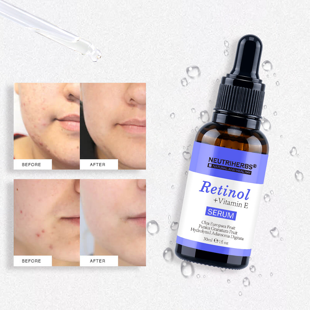 Neutriherbs Retinol(0.5%) Serum With Vitamin E For Face - 30ml - Neutriherbs SA