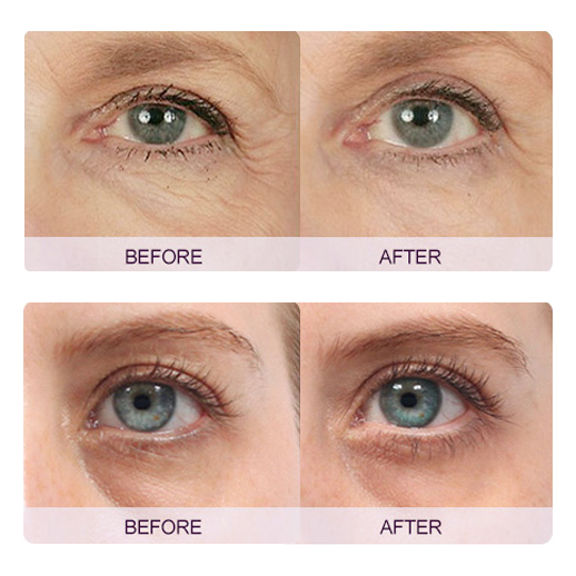 Neutriherbs Pro-Retinol Rapid Wrinkle Repair Eye Cream - 15g - Neutriherbs SA