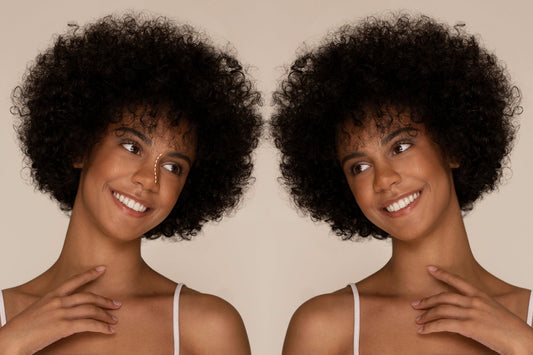 How Hormones Affect Hyperpigmentation in SA Women. A mirror image of an African model