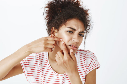 Winter Sensitivity: How to Calm Irritated SA Skin