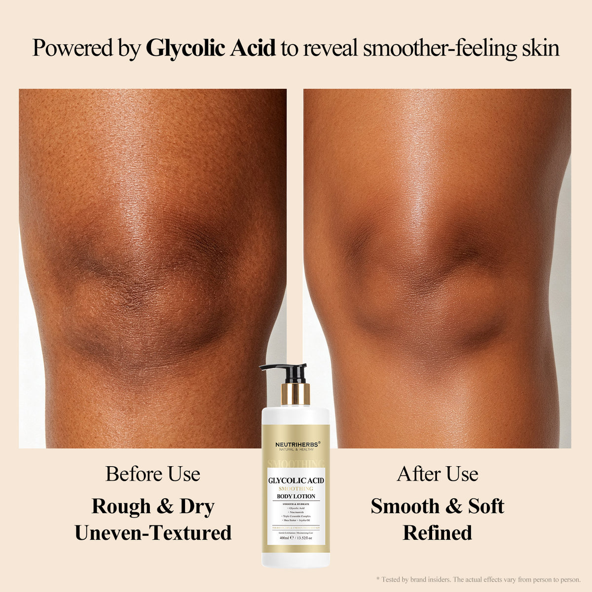 Neutriherbs Glycolic Acid Smoothing Body Lotion For Rough & Dry Skin