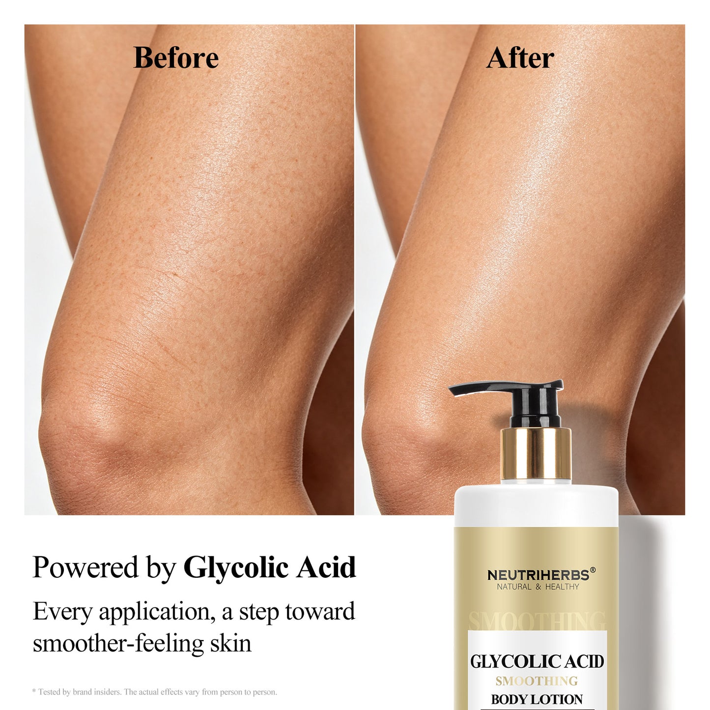 Neutriherbs Glycolic Acid Smoothing Body Lotion For Rough & Dry Skin