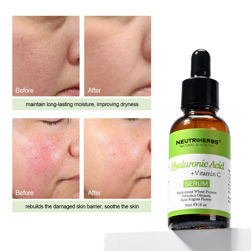Neutriherbs Hyaluronic Acid Serum with Vitamin C - 30ml