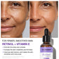 Neutriherbs Retinol Serum for Acne, Texture & Skin Renewal - 30ml
