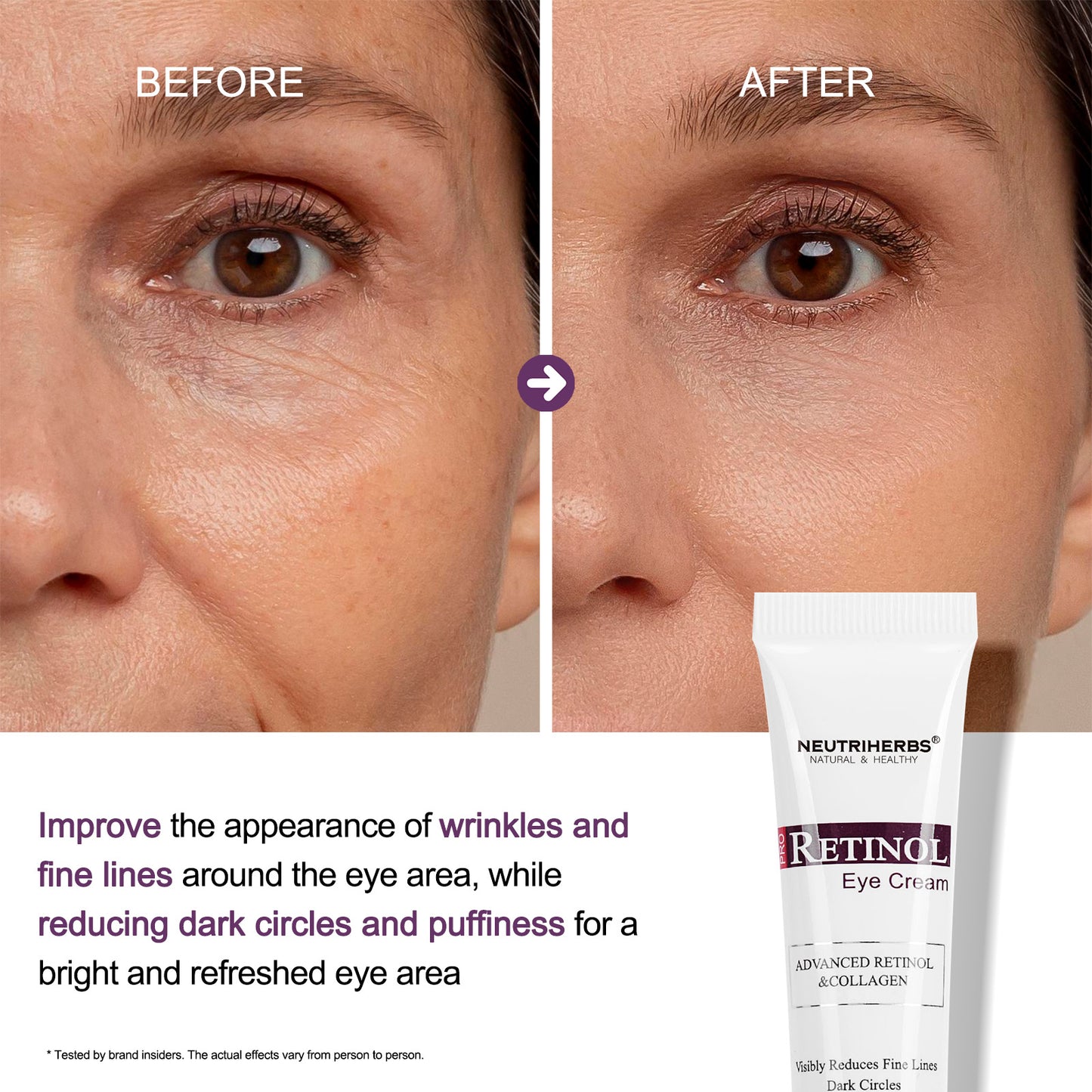 Neutriherbs Retinol Eye Care Series