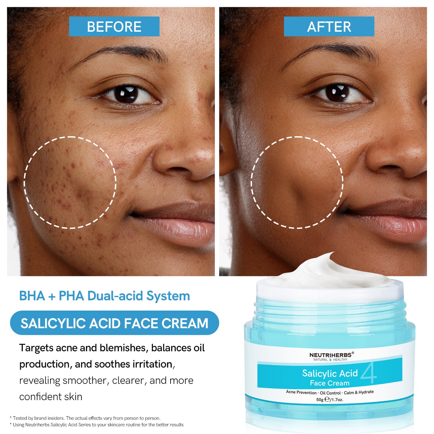 Salicylic Acid Cream & Cleanser & Treatment