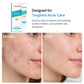 Neutriherbs Salicylic Acid Oil Balance & Acne Control Set for Oily Skin and Breakouts