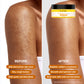 Weekly Body Polish &amp; Glow Care Set for Dull & Rough Body Skin
