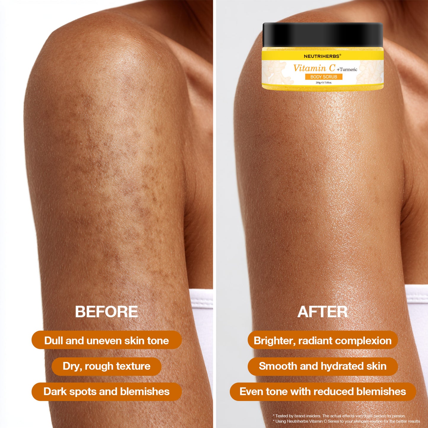 Weekly Body Polish &amp; Glow Care Set for Dull & Rough Body Skin