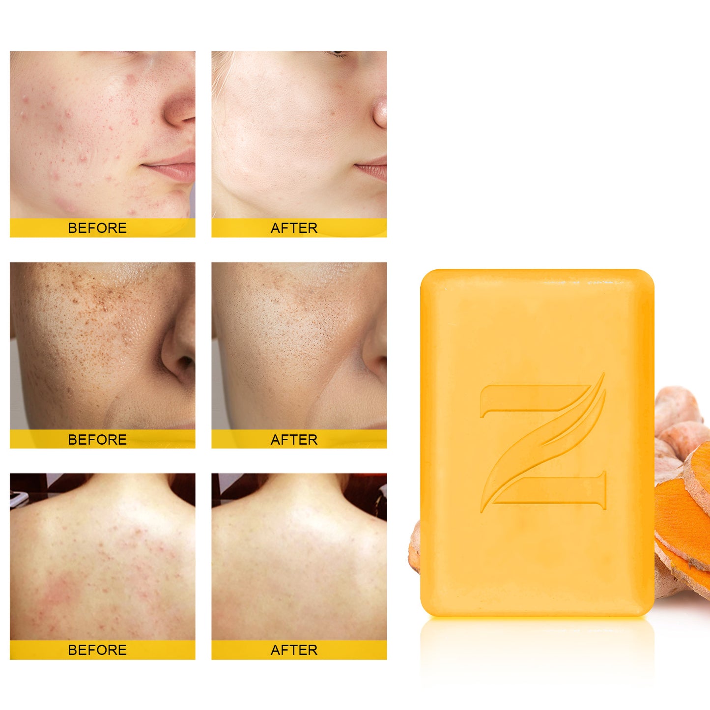 Weekly Body Polish &amp; Glow Care Set for Dull & Rough Body Skin