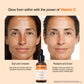 Neutriherbs Vitamin C Serum for Dark Spots – Brighten & Even Skin Tone