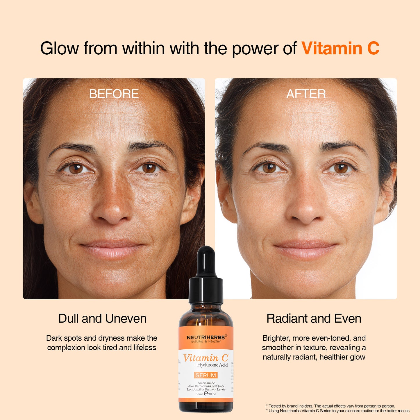 Neutriherbs Vitamin C Serum for Dark Spots – Brighten & Even Skin Tone