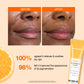 Vitamin C Lip Treatment Smooth Cream